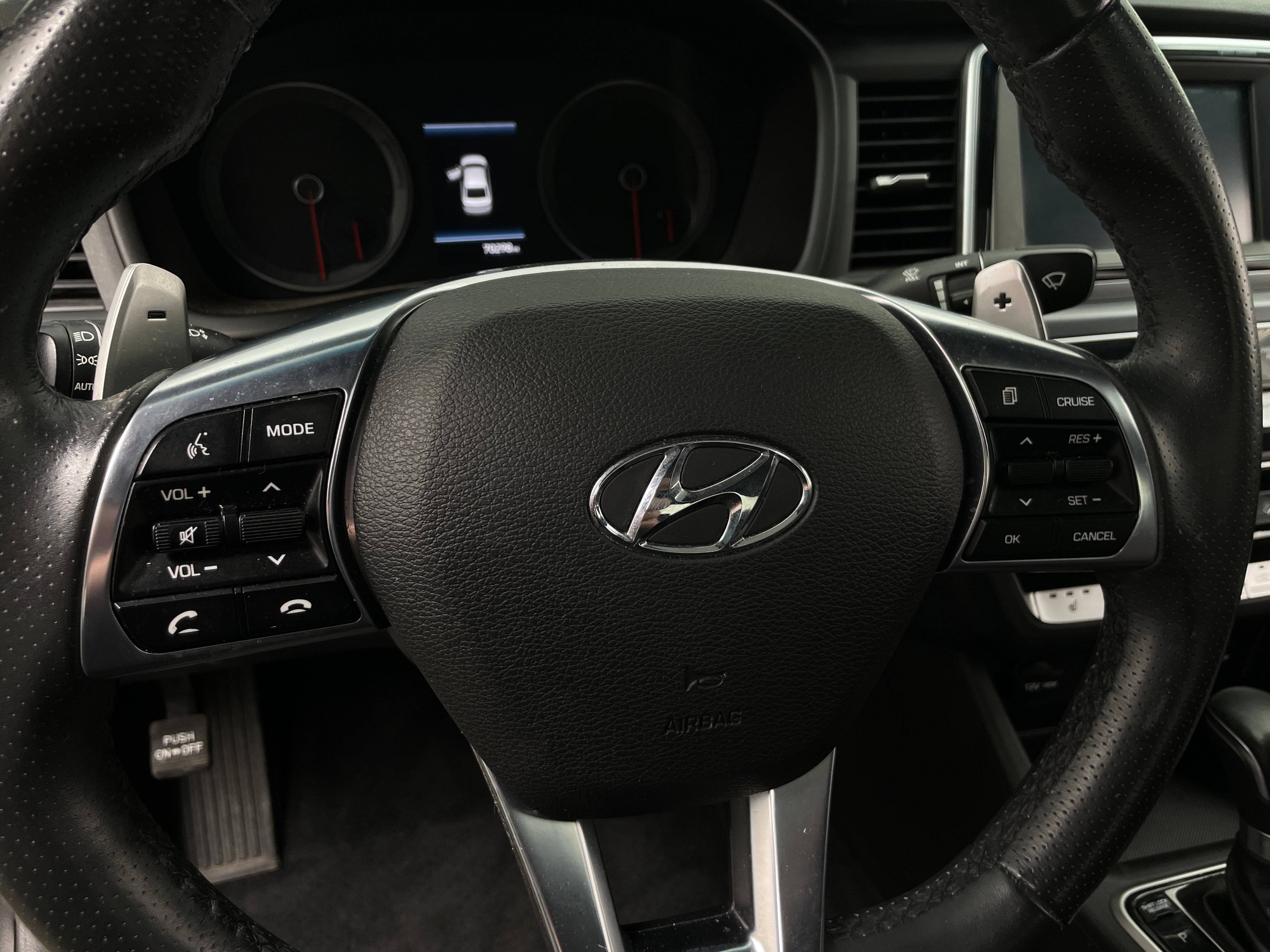 2018 Hyundai Sonata Sport 5