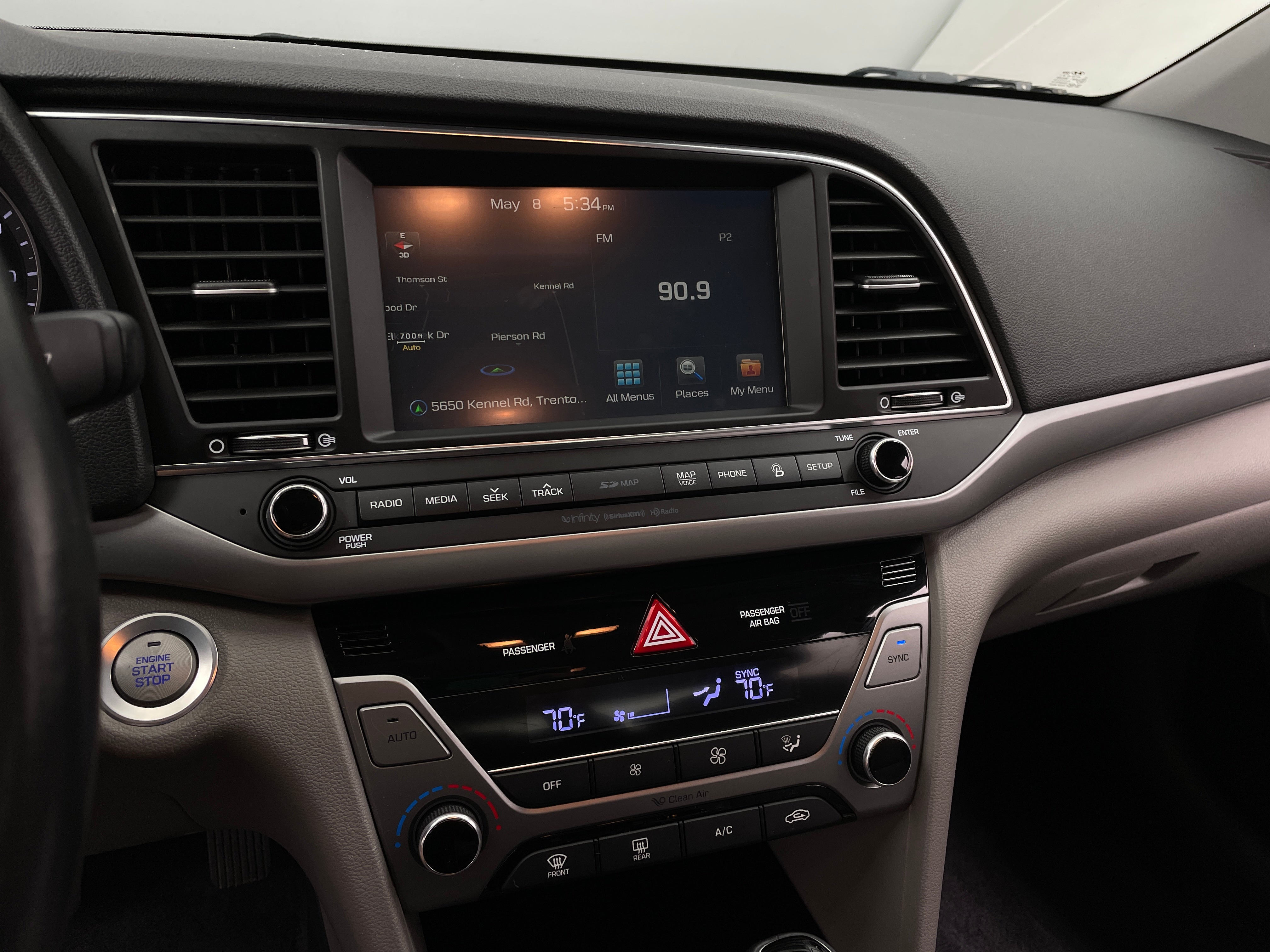 2017 Hyundai Elantra Limited Edition 3