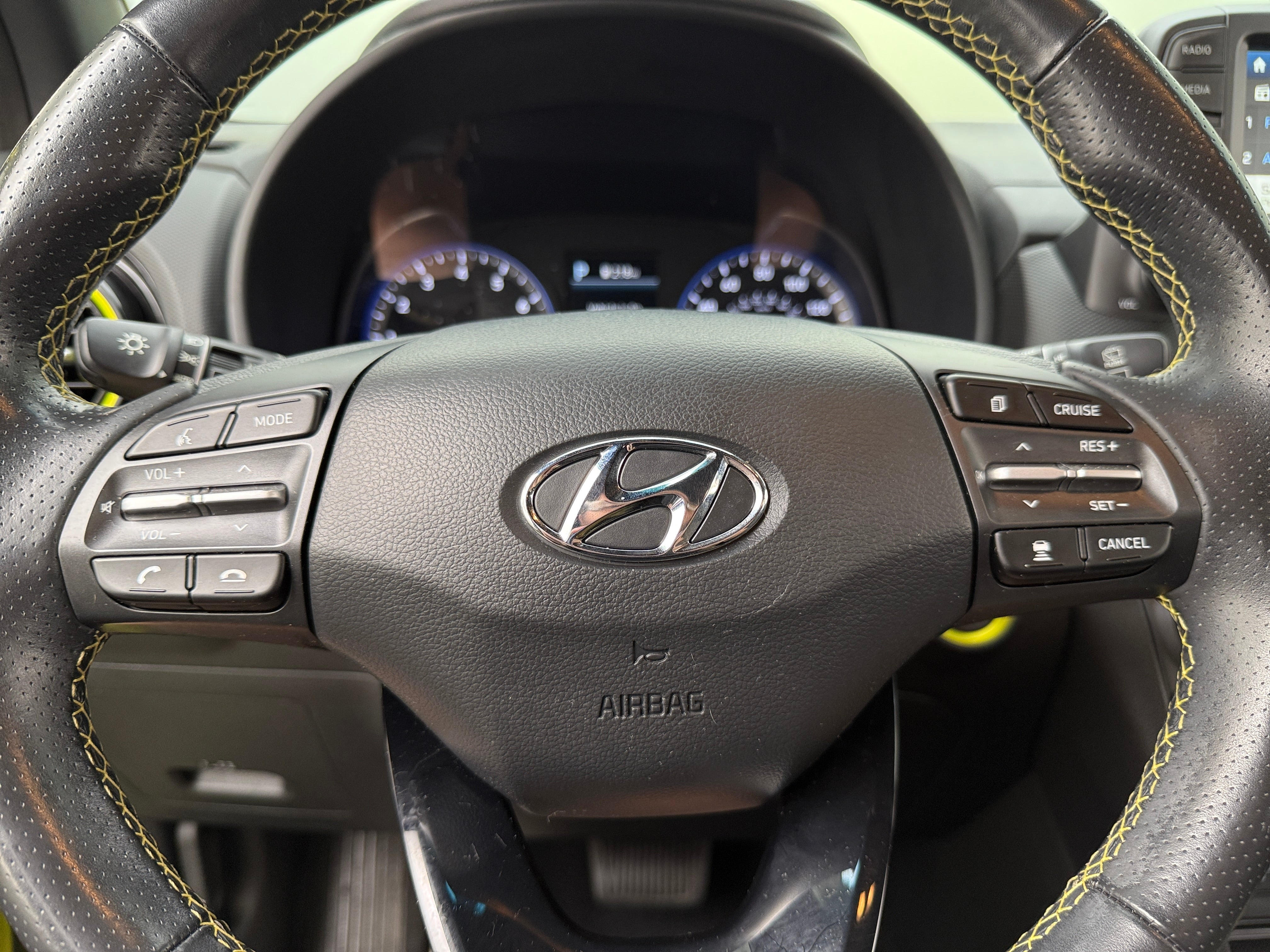 2020 Hyundai Kona Ultimate 4