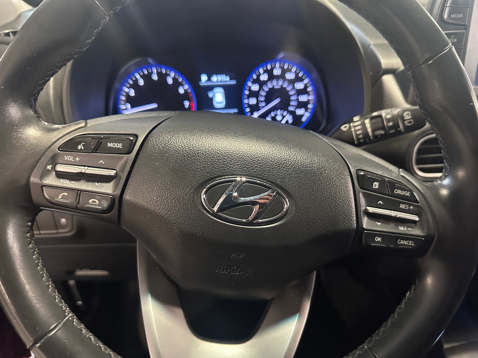 Thumbnail: 2018 Hyundai Kona - 5