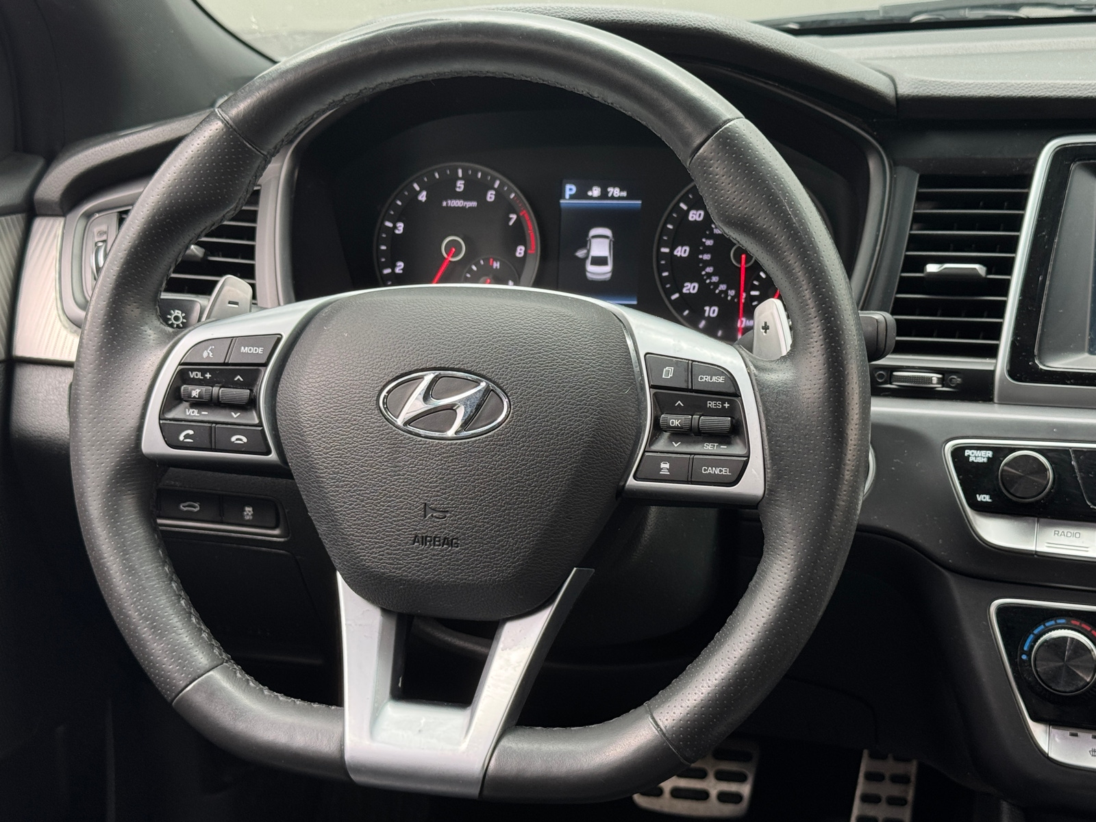 Thumbnail: 2018 Hyundai Sonata - 4